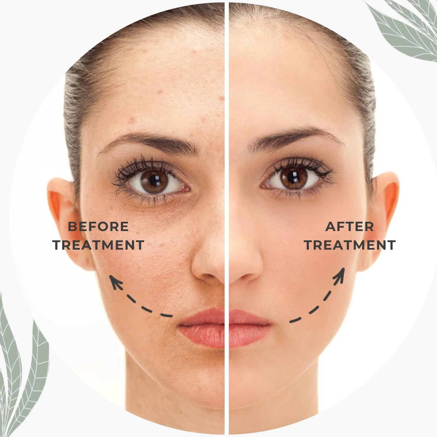 Kosmetik & Waxing by Natalie Lammert - Reinigungsbehandlung